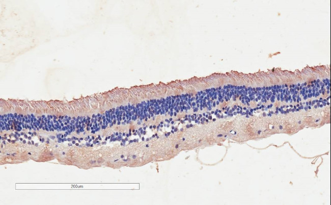 CNGB3 Antibody in Immunohistochemistry (Paraffin) (IHC (P))