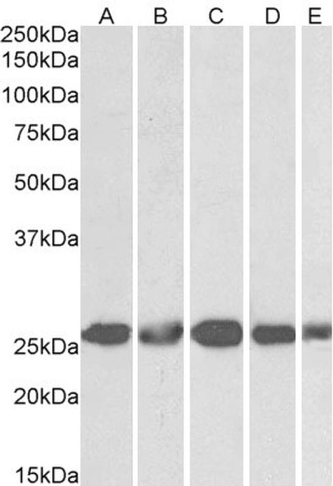 CK2 beta Antibody in Western Blot (WB)