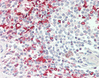 HMBS Antibody in Immunohistochemistry (Paraffin) (IHC (P))