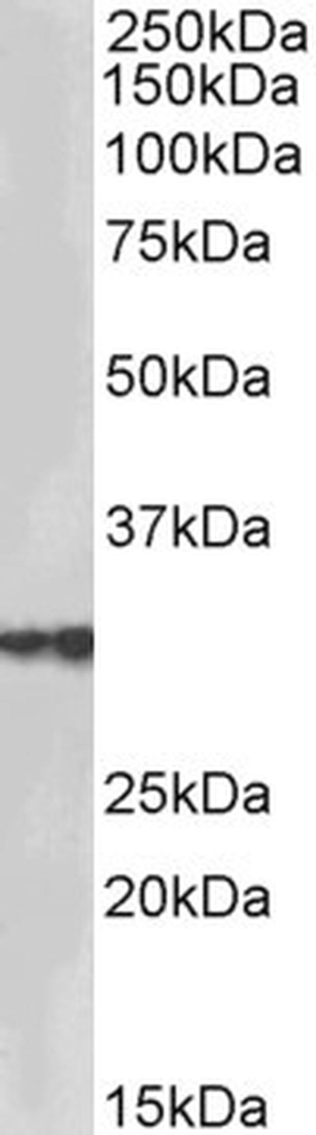 HSD17B3 Antibody in Western Blot (WB)