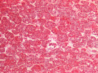 HSPE1 Antibody in Immunohistochemistry (Paraffin) (IHC (P))