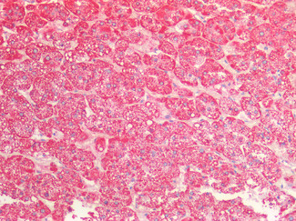 HSPE1 Antibody in Immunohistochemistry (Paraffin) (IHC (P))