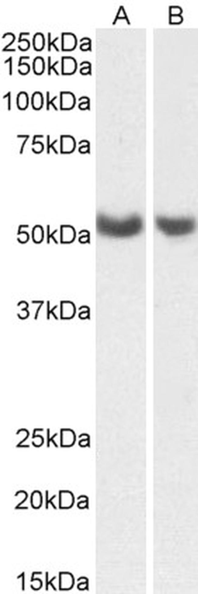 PTGIS Antibody in Western Blot (WB)