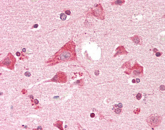 PTGES2 Antibody in Immunohistochemistry (Paraffin) (IHC (P))