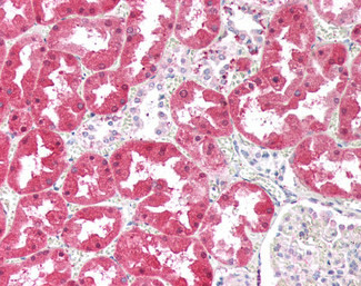 KHK Antibody in Immunohistochemistry (Paraffin) (IHC (P))