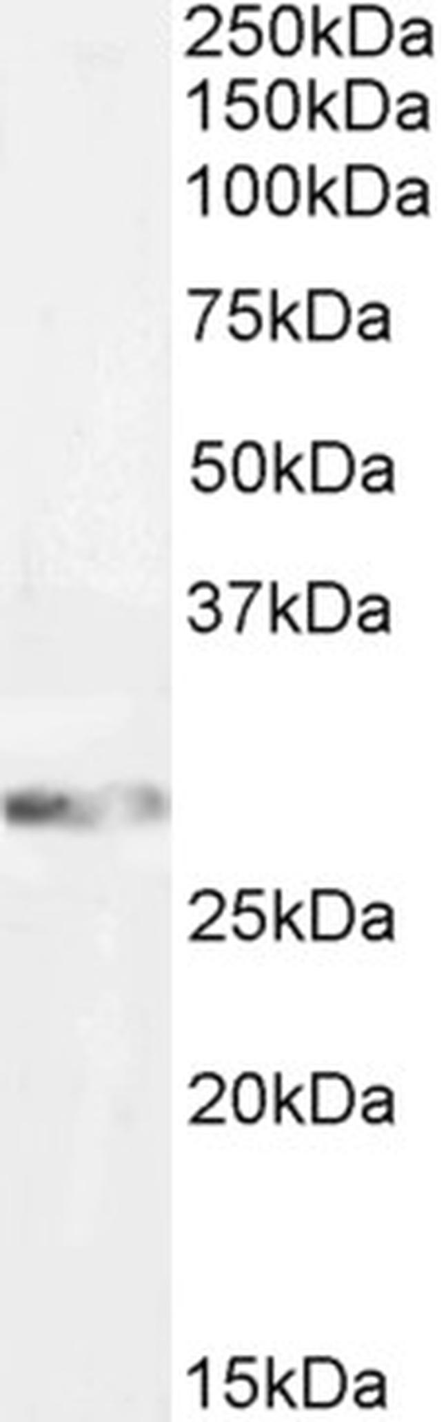 GSTM3 Antibody in Western Blot (WB)