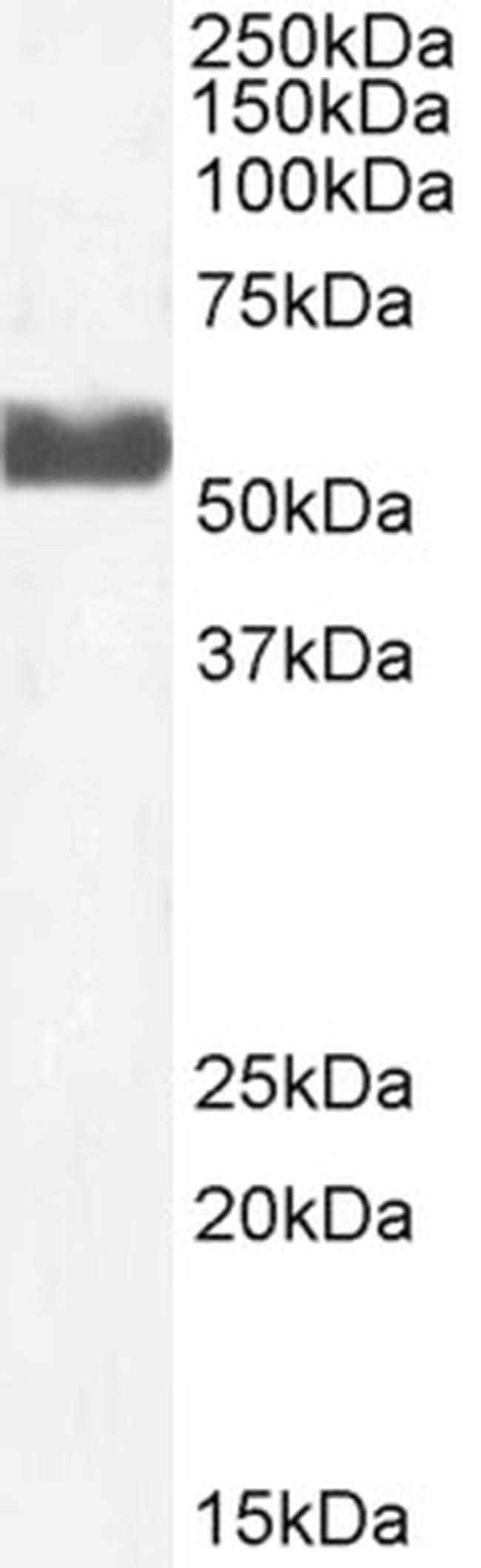 CYP2D6 Antibody in Western Blot (WB)