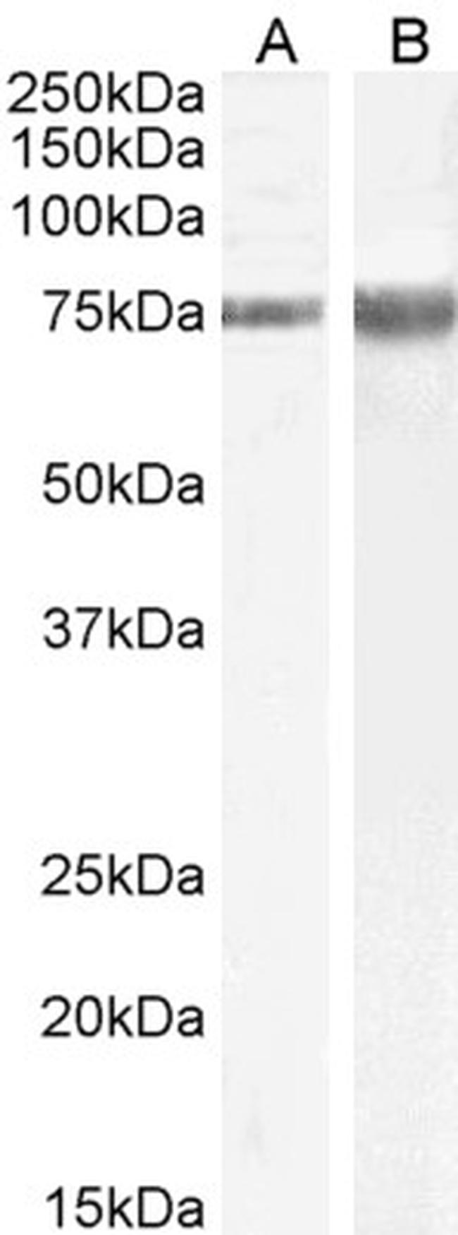 JIP1 Antibody in Western Blot (WB)