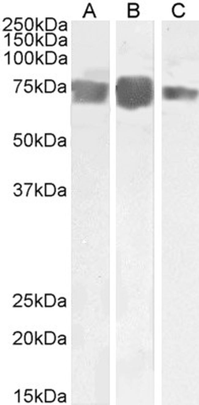 CD146 Antibody in Western Blot (WB)