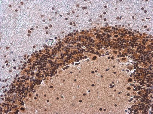 Phospho-IRS1 (Ser307) Antibody in Immunohistochemistry (Paraffin) (IHC (P))
