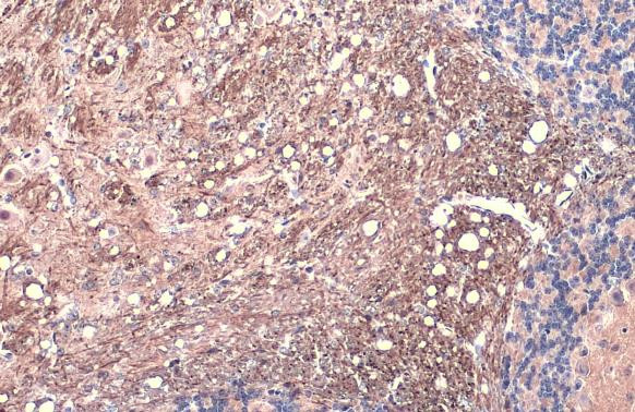 Phospho-Tau (Thr181) Antibody in Immunohistochemistry (Paraffin) (IHC (P))