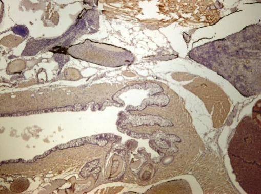 EEF1A1 Antibody in Immunohistochemistry (Paraffin) (IHC (P))