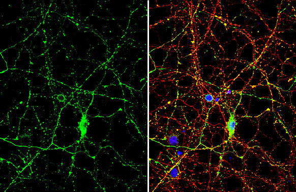 Synapsin Pan Antibody in Immunocytochemistry (ICC/IF)