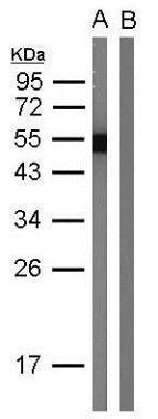 Protein A Antibody in Western Blot (WB)