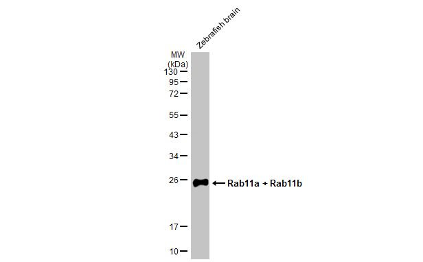 RAB11A/RAB11B Antibody in Western Blot (WB)