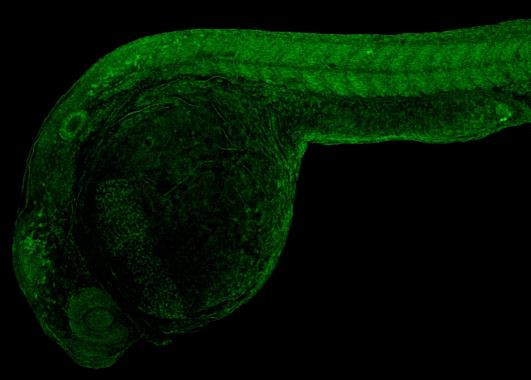 MITFA Antibody in Immunohistochemistry (PFA fixed) (IHC (PFA))