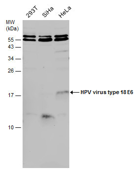 HPV Type 18 E6 Antibody in Western Blot (WB)