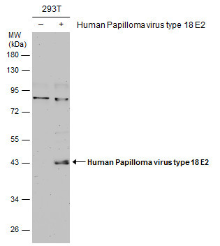 HPV Type 18 E2 Antibody in Western Blot (WB)