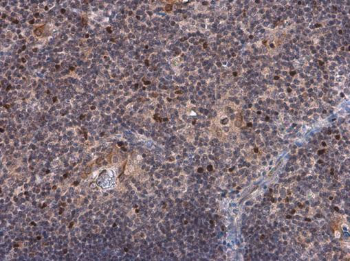EOMES Antibody in Immunohistochemistry (Paraffin) (IHC (P))