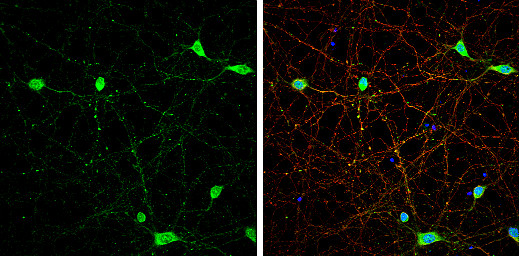 VGLUT3 Antibody in Immunocytochemistry (ICC/IF)
