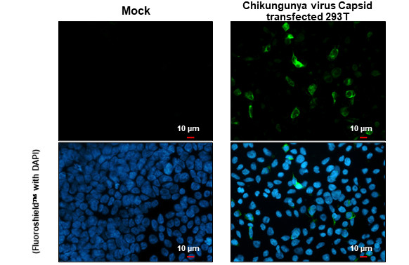 Chikungunya Virus Capsid Antibody in Immunocytochemistry (ICC/IF)