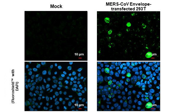 MERS Coronavirus Envelope Protein Antibody in Immunocytochemistry (ICC/IF)