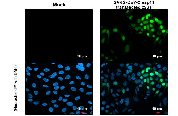 SARS-CoV-2 NSP11 (strain Wuhan-Hu-1) Antibody in Immunocytochemistry (ICC/IF)