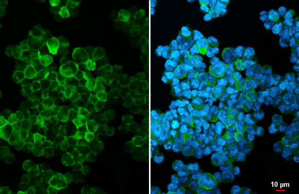 HLA-DQA1 Antibody in Immunocytochemistry (ICC/IF)