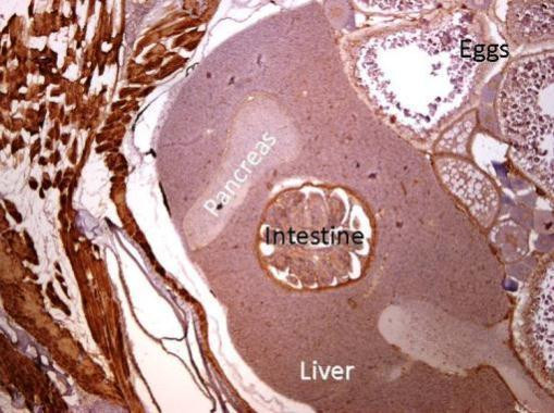 alpha-Cardiac Actin Antibody in Immunohistochemistry (Paraffin) (IHC (P))