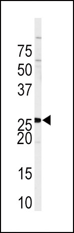 SPRY4 Antibody in Western Blot (WB)