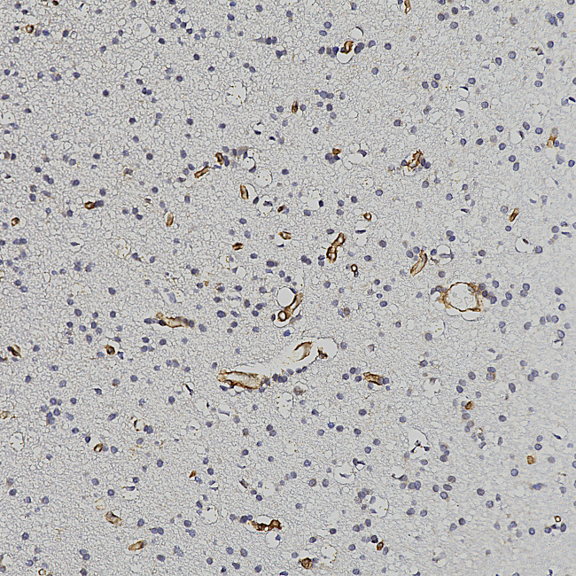 Nestin Antibody in Immunohistochemistry (Paraffin) (IHC (P))