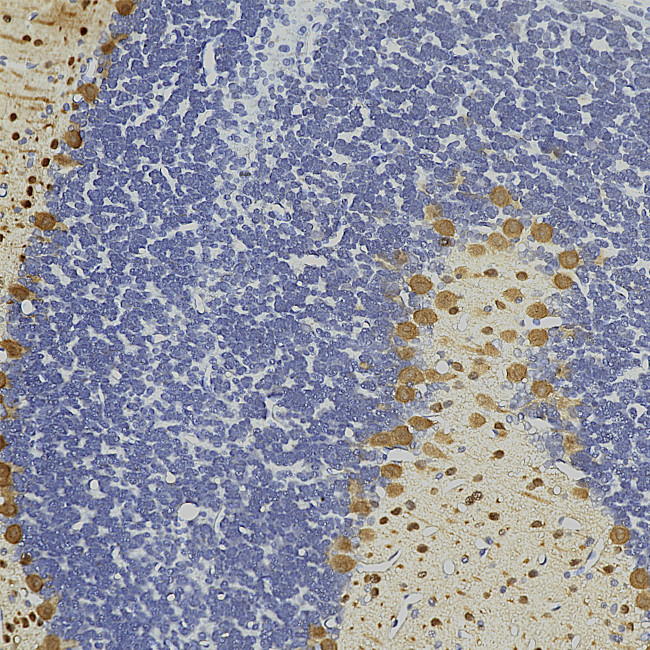 Parvalbumin Antibody in Immunohistochemistry (Paraffin) (IHC (P))