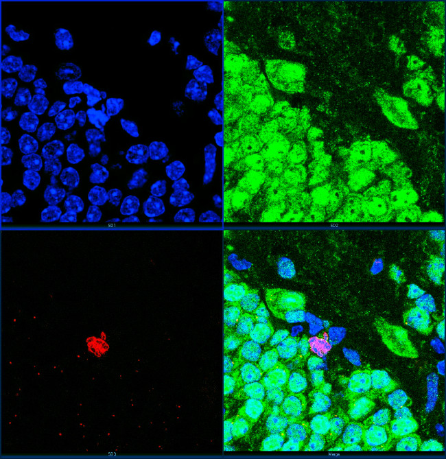Ki-67 Antibody in Immunocytochemistry (ICC/IF)