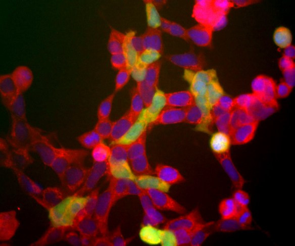 NSE Antibody in Immunocytochemistry (ICC/IF)