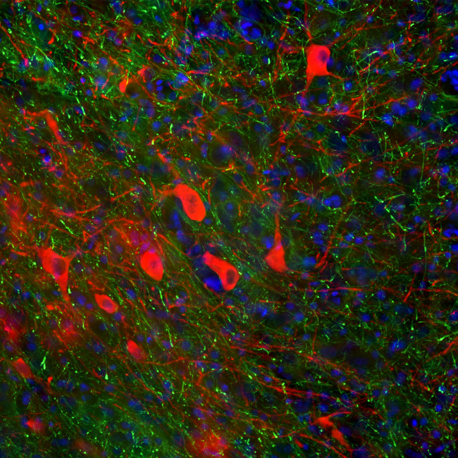 Tyrosine Hydroxylase Antibody in Immunohistochemistry (PFA fixed) (IHC (PFA))