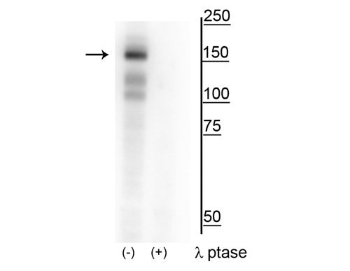 Phospho-MERTK (Tyr749, Tyr753, Tyr754) Antibody in Western Blot (WB)
