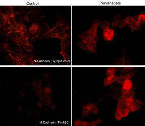 Phospho-N-cadherin (Tyr820) Antibody in Immunocytochemistry (ICC/IF)