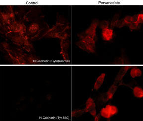 Phospho-N-cadherin/E-cadherin (Tyr820, Tyr835, Tyr860) Antibody in Immunocytochemistry (ICC/IF)