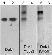 Phospho-DOK1/DOK2 (Tyr362, Tyr337) Antibody in Western Blot (WB)