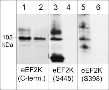 Phospho-EEF2K (Ser398) Antibody in Western Blot (WB)