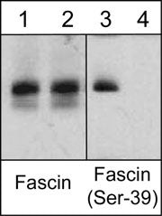 Phospho-Fascin (Ser39) Antibody in Western Blot (WB)