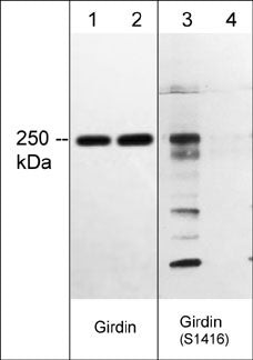 Phospho-Girdin (Ser1416) Antibody in Western Blot (WB)