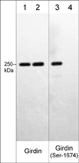 Phospho-Girdin (Ser1674) Antibody in Western Blot (WB)