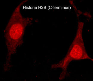 Histone H2B Antibody in Immunocytochemistry (ICC/IF)