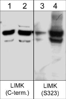 Phospho-LIMK1/LIMK2 (Ser323, Ser314) Antibody in Western Blot (WB)