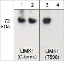 Phospho-LIMK1/LIMK2 (Thr508, Thr505) Antibody in Western Blot (WB)