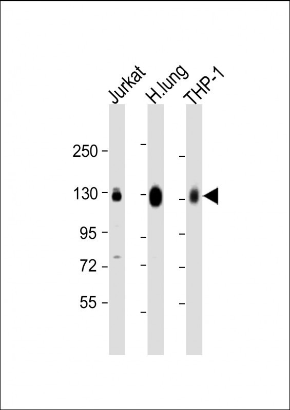 CD31 Antibody in Western Blot (WB)