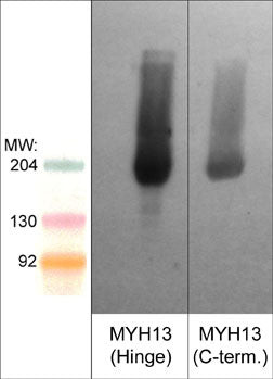 MYH13 Antibody in Western Blot (WB)