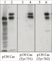 Phospho-p130Cas (Tyr762) Antibody in Western Blot (WB)