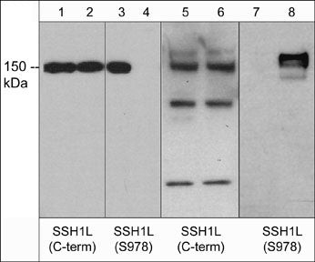 SSH1 Antibody in Western Blot (WB)